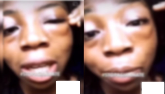 Lady reveals what her madam did to her face after being caught in bed with her husband (Video) - side chic madam husband 1