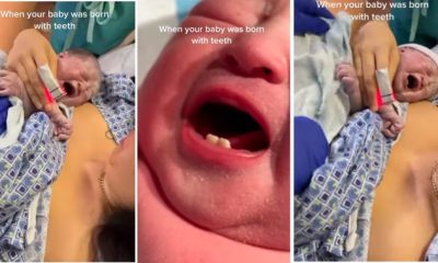 Woman in disbelief as she gives birth to baby with teeth - woman newborn baby teeth 1