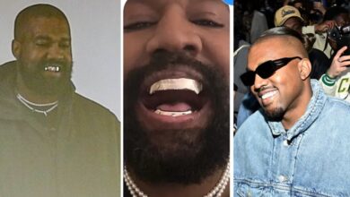 Kanye West fixes James Bond-inspired $850k titanium dentures