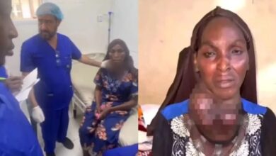 Woman who collected N300k cash and rejected operation to remove goitre is dead